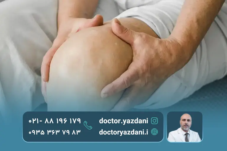 کاهش تورم پس از تزریف سلول بنیادی به زانو